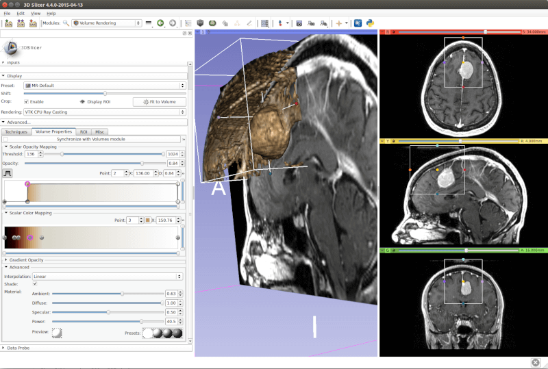 3D Slicer - Image Analysis and Scientific Visualization