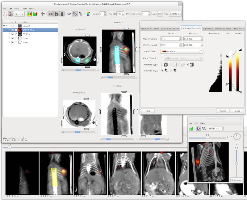 AMIDE - Medical Imaging Data Examiner