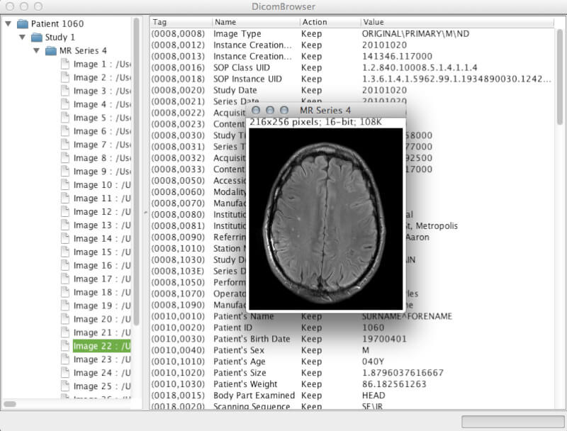 DicomBrowser - Viewing and Modifying DICOM Metadata