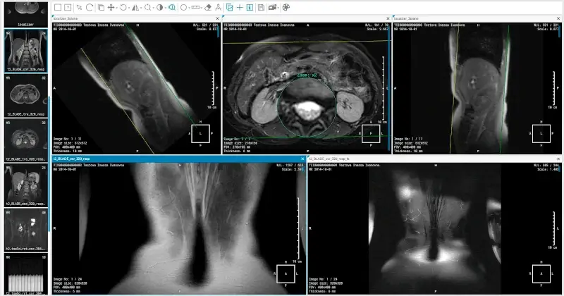 Inobitec DICOM Viewer