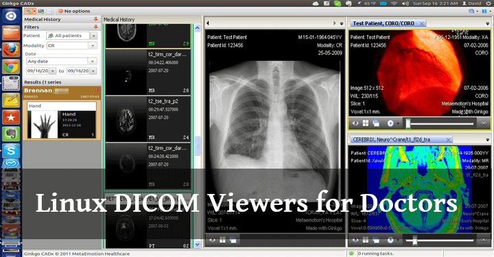 Linux DICOM Viewers for Doctors