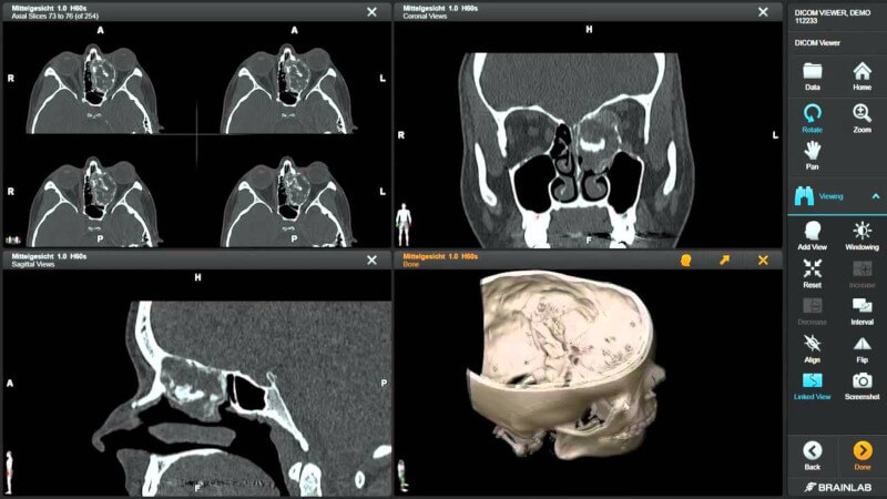 Mango – Multi-image Analysis GUI