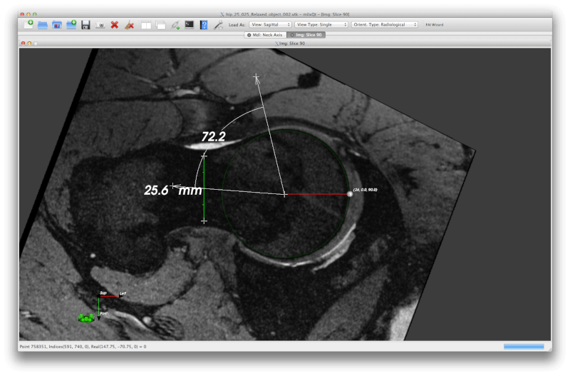 SMILI - Simple Medical Imaging Library Interface